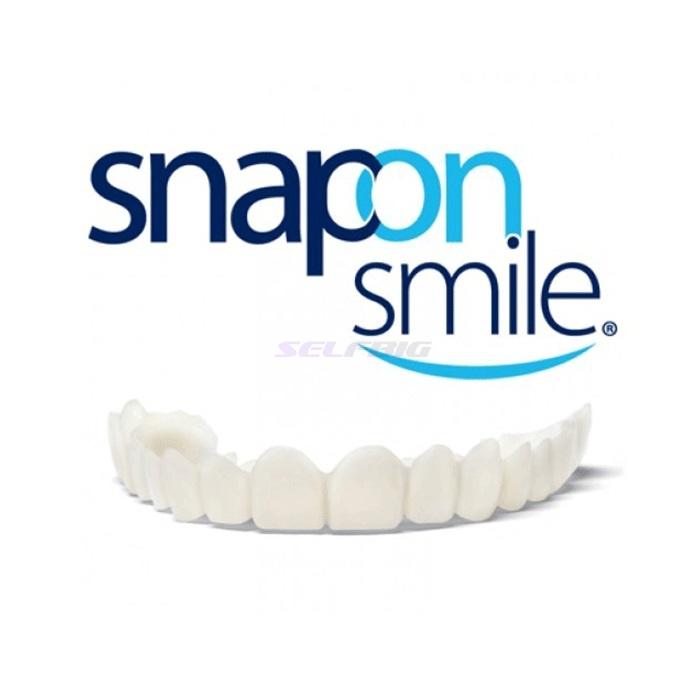 Snap-On Smile